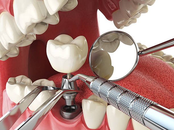Best Emergency Tooth Extraction in Stewartstown, PA